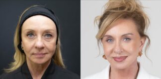 “Bem-vindos ao luxo”: facelift reforça imagem de corretora de alto padrão Mônica Poplawski, corretora especializada no mercado imobiliário de luxo em Alphaville, São Paulo, utiliza a própria imagem como uma das ferramentas de seu trabalho.