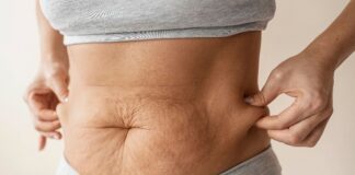 Excesso de pele após emagrecimento: por que acontece e quando a cirurgia deixa de ser estética para virar necessidade